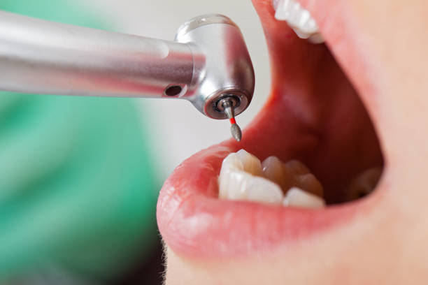 Best Emergency Gum Pain Relief  in East Palatka, FL
